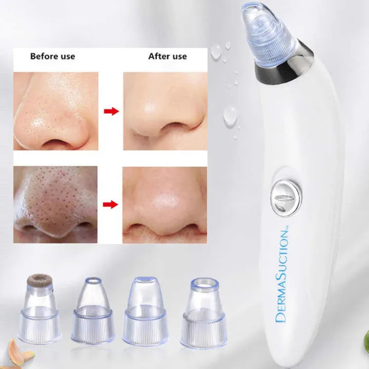 Derma Suction Blackhead Acne Oil Remover Vacuum Suction Face Pore Cleaner Facial Beauty Equipment