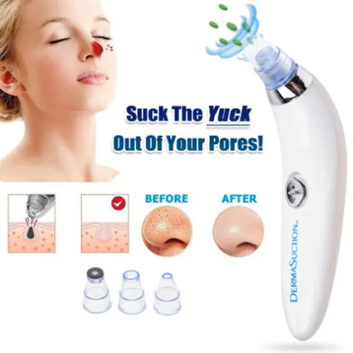 Derma Suction Blackhead Acne Oil Remover Vacuum Suction Face Pore Cleaner Facial Beauty Equipment